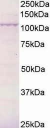Anti-BCAR3 antibody, C-term used in Western Blot (WB). GTX89796