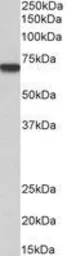 Anti-MTM1 antibody, C-term used in Western Blot (WB). GTX89799