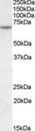 Anti-MTM1 antibody, C-term used in Western Blot (WB). GTX89799