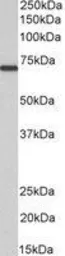 Anti-MTM1 antibody, C-term used in Western Blot (WB). GTX89799