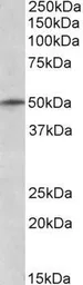Anti-TRIM35 antibody, N-term used in Western Blot (WB). GTX89803