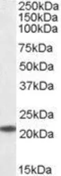 Anti-UBE2T antibody, C-term used in Western Blot (WB). GTX89819