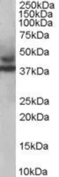 Anti-MURF3 antibody, C-term used in Western Blot (WB). GTX89822