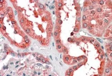Anti-CYT19 antibody, N-term used in IHC (Paraffin sections) (IHC-P). GTX89825