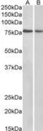 Anti-TRIM3 antibody, N-term used in Western Blot (WB). GTX89826