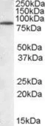 Anti-TRIM3 antibody, N-term used in Western Blot (WB). GTX89826