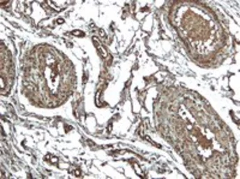Anti-NLRP3 ( C Terminus) antibody, C-term used in IHC (Paraffin sections) (IHC-P). GTX89829