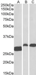 Anti-ANP32B antibody, C-term used in Western Blot (WB). GTX89831