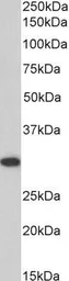 Anti-ANP32B antibody, C-term used in Western Blot (WB). GTX89831