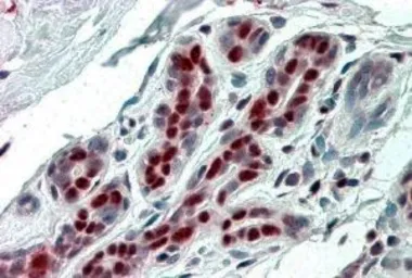 Anti-ANP32B antibody, C-term used in IHC (Paraffin sections) (IHC-P). GTX89831