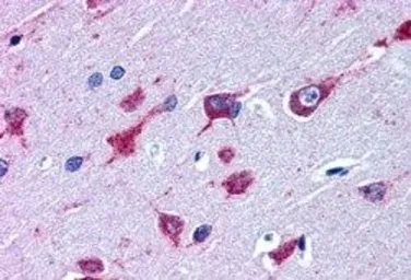 Anti-ALS2 antibody, C-term used in IHC (Paraffin sections) (IHC-P). GTX89837