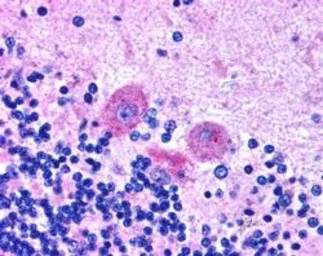 Anti-SNX26 / TCGAP antibody, C-term used in IHC (Paraffin sections) (IHC-P). GTX89840