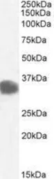 Anti-CBR1 antibody, C-term used in Western Blot (WB). GTX89841