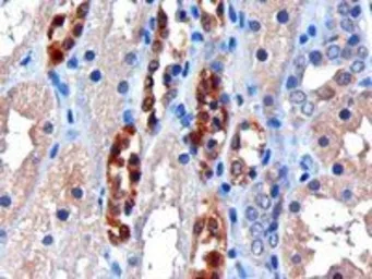 Anti-CBR1 antibody, C-term used in IHC (Paraffin sections) (IHC-P). GTX89841
