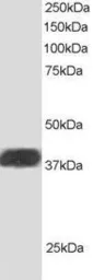 Anti-ALS2CR1 antibody, C-term used in Western Blot (WB). GTX89849
