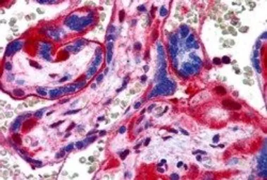 Anti-Annexin XI antibody, N-term used in IHC (Paraffin sections) (IHC-P). GTX89851