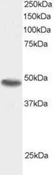 Anti-SNX15 antibody, C-term used in Western Blot (WB). GTX89856