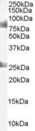 Anti-CDYL antibody, C-term used in Western Blot (WB). GTX89858