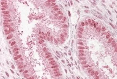 Anti-NUP50 antibody, C-term used in IHC (Paraffin sections) (IHC-P). GTX89862