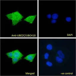 Anti-UBE2C antibody, C-term used in Immunocytochemistry/ Immunofluorescence (ICC/IF). GTX89866