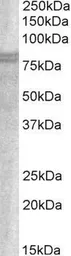 Anti-SNX18 antibody, C-term used in Western Blot (WB). GTX89870