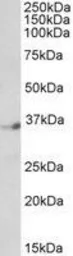 Anti-DPF1 antibody, C-term used in Western Blot (WB). GTX89872