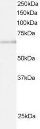 Anti-ARIH1 antibody, C-term used in Western Blot (WB). GTX89873