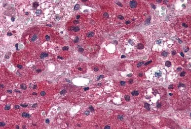 Anti-ARIH1 antibody, C-term used in IHC (Paraffin sections) (IHC-P). GTX89873