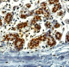 Anti-KAP1 antibody, C-term used in IHC (Paraffin sections) (IHC-P). GTX89879