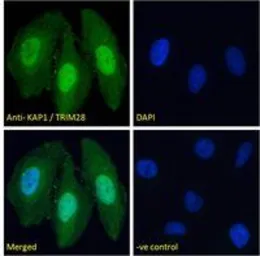 Anti-KAP1 antibody, C-term used in Immunocytochemistry/ Immunofluorescence (ICC/IF). GTX89879
