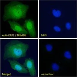 Anti-KAP1 antibody, C-term used in Immunocytochemistry/ Immunofluorescence (ICC/IF). GTX89879