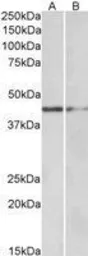 Anti-GATA3 antibody, N-term used in Western Blot (WB). GTX89886
