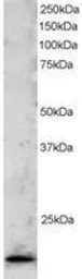 Anti-TLP antibody, C-term used in Western Blot (WB). GTX89890
