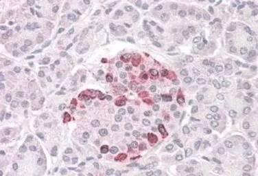 Anti-SOCS4 antibody, C-term used in IHC (Paraffin sections) (IHC-P). GTX89892