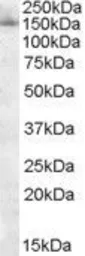 Anti-SAP130 antibody, C-term used in Western Blot (WB). GTX89893
