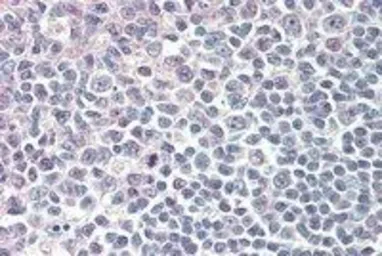 Anti-IRF8 antibody, C-term used in IHC (Paraffin sections) (IHC-P). GTX89895