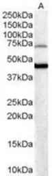 Anti-FOXG1 antibody, C-term used in Western Blot (WB). GTX89897