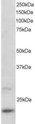 Anti-ARL2 antibody, C-term used in Western Blot (WB). GTX89899