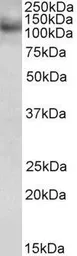 Anti-RNF31 antibody, C-term used in Western Blot (WB). GTX89901