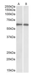 Anti-IRF5 antibody, C-term used in Western Blot (WB). GTX89902