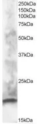 Anti-CABP1 antibody, N-term used in Western Blot (WB). GTX89905