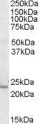 Anti-KLF16 antibody, C-term used in Western Blot (WB). GTX89911