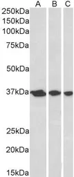 Anti-APE1 antibody, N-term used in Western Blot (WB). GTX89912