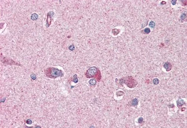 Anti-LIS1 antibody, C-term used in IHC (Paraffin sections) (IHC-P). GTX89916