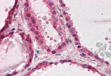 Anti-LIS1 antibody, C-term used in IHC (Paraffin sections) (IHC-P). GTX89916