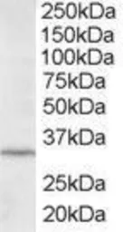 Anti-ING2 antibody, C-term used in Western Blot (WB). GTX89918