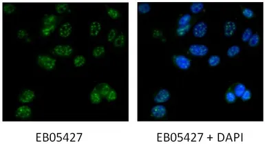 Anti-DAP3 antibody, C-term used in Immunocytochemistry/ Immunofluorescence (ICC/IF). GTX89921