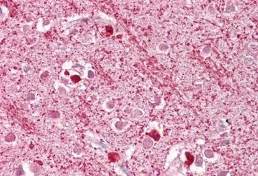 Anti-DAP3 antibody, C-term used in IHC (Paraffin sections) (IHC-P). GTX89921