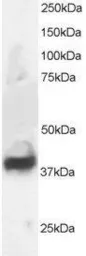 Anti-Septin 3 antibody, N-term used in Western Blot (WB). GTX89929
