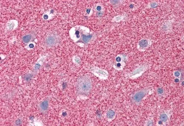 Anti-Septin 3 antibody, N-term used in IHC (Paraffin sections) (IHC-P). GTX89929